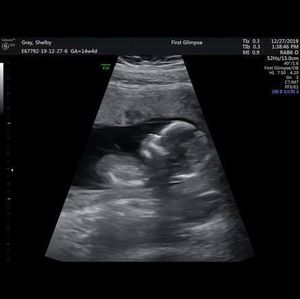 Meet your Posher, Shelby